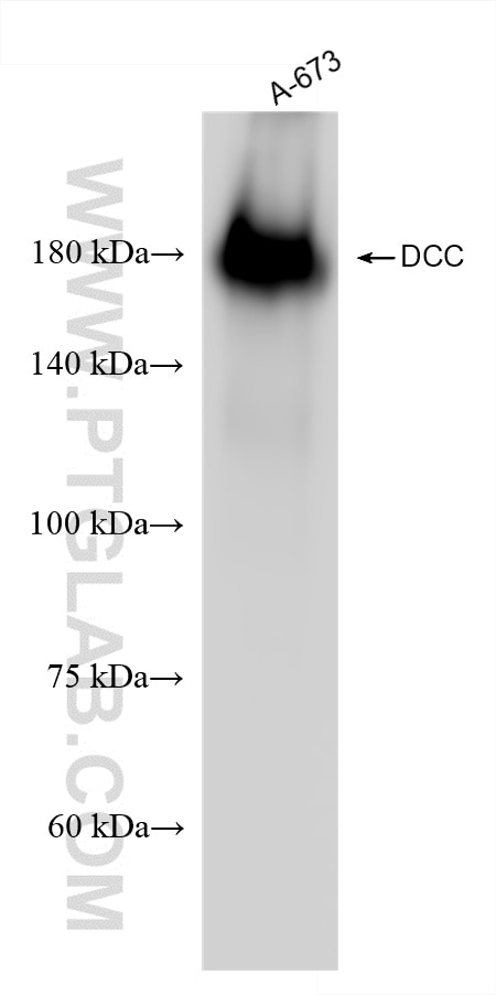 Western Blot (WB) analysis of A-673 cells using DCC Recombinant antibody (85787-4-RR)