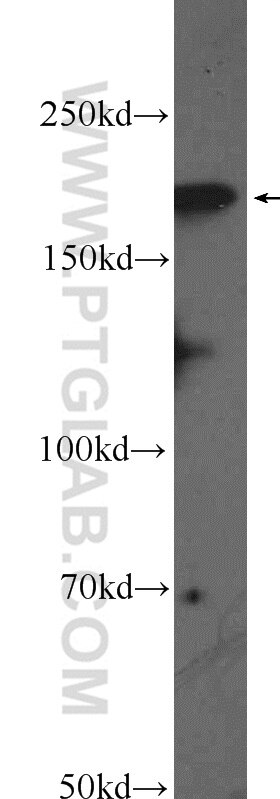 Western Blot (WB) analysis of mouse brain tissue using DCC-Specific Polyclonal antibody (19123-1-AP)