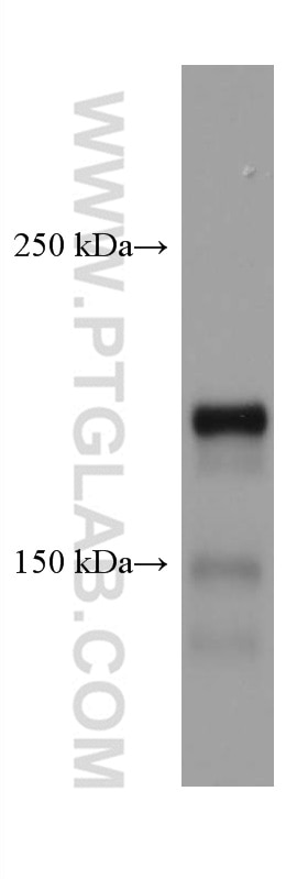 Western Blot (WB) analysis of mouse brain tissue using DCC-Specific Monoclonal antibody (67203-1-Ig)
