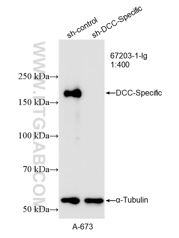 WB analysis of A-673 using 67203-1-Ig Western Blot (WB) analysis of A-673 cells using DCC-Specific Monoclonal antibody (67203-1-Ig)