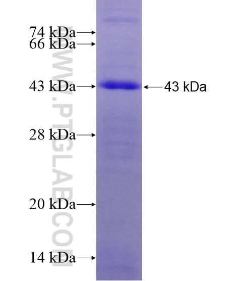 DCC-Specific fusion protein Ag20569 SDS-PAGE