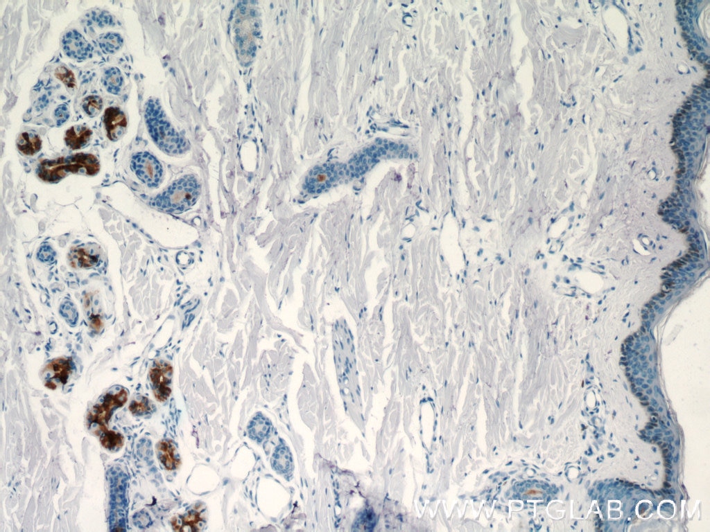 Immunohistochemistry (IHC) staining of human skin tissue using DCD Polyclonal antibody (11985-1-AP)
