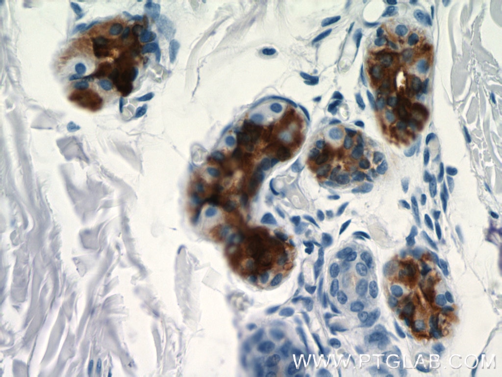 Immunohistochemistry (IHC) staining of human skin tissue using DCD Polyclonal antibody (11985-1-AP)