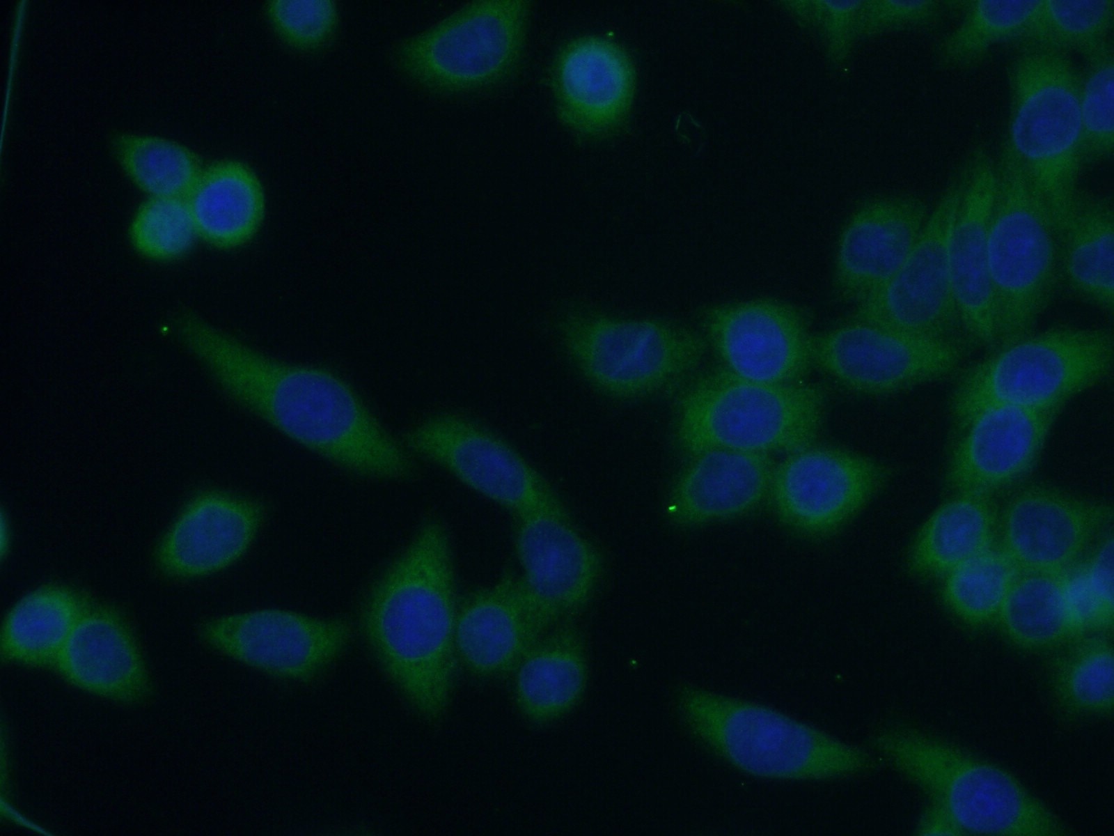 Immunofluorescence (IF) / fluorescent staining of HeLa cells using DCDC2 Polyclonal antibody (26978-1-AP)