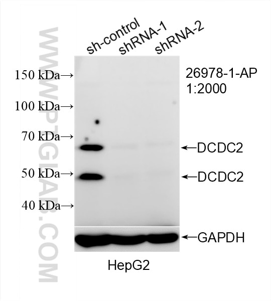 Western Blot (WB) analysis of HepG2 cells using DCDC2 Polyclonal antibody (26978-1-AP)
