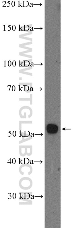 Western Blot (WB) analysis of mouse placenta tissue using DCDC2 Polyclonal antibody (26978-1-AP)