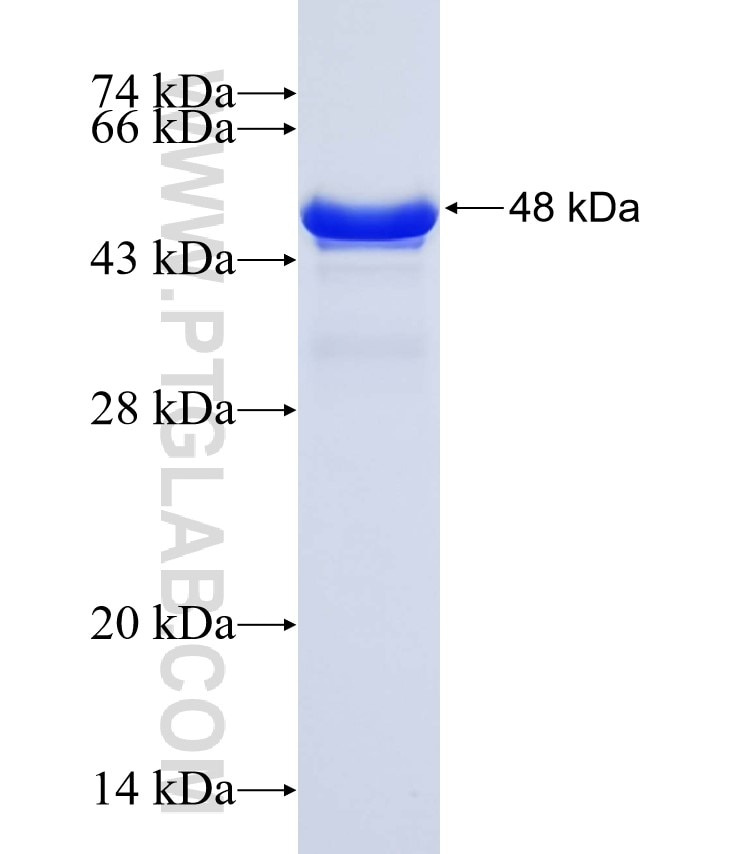 DCDC2 fusion protein Ag25577 SDS-PAGE
