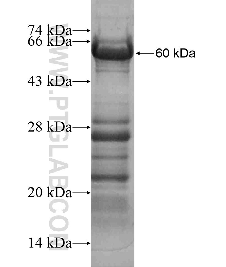 DCDC2 fusion protein Ag17287 SDS-PAGE