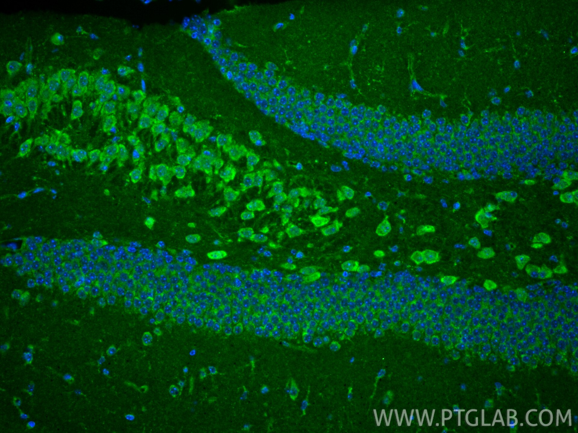 Immunofluorescence (IF) / fluorescent staining of mouse brain tissue using DCHS1 Polyclonal antibody (28144-1-AP)