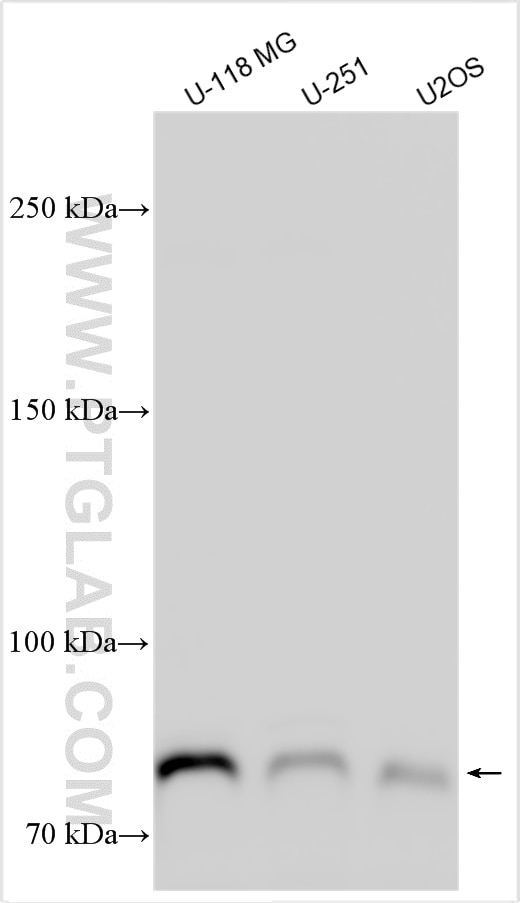 Western Blot (WB) analysis of various lysates using DCHS2 Polyclonal antibody (31631-1-AP)