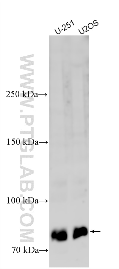 Western Blot (WB) analysis of various lysates using DCHS2 Polyclonal antibody (31631-1-AP)