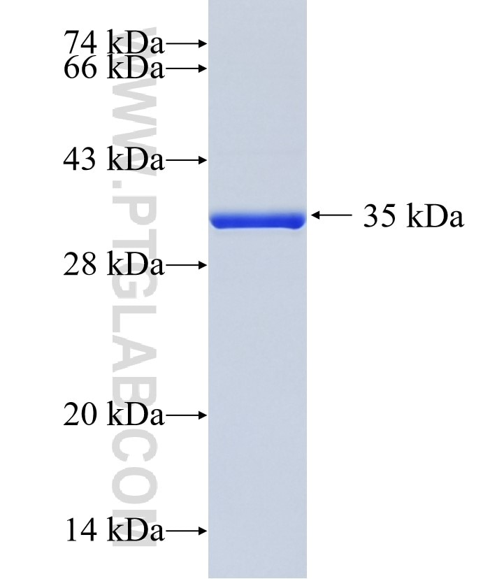 DCHS2 fusion protein Ag35080 SDS-PAGE
