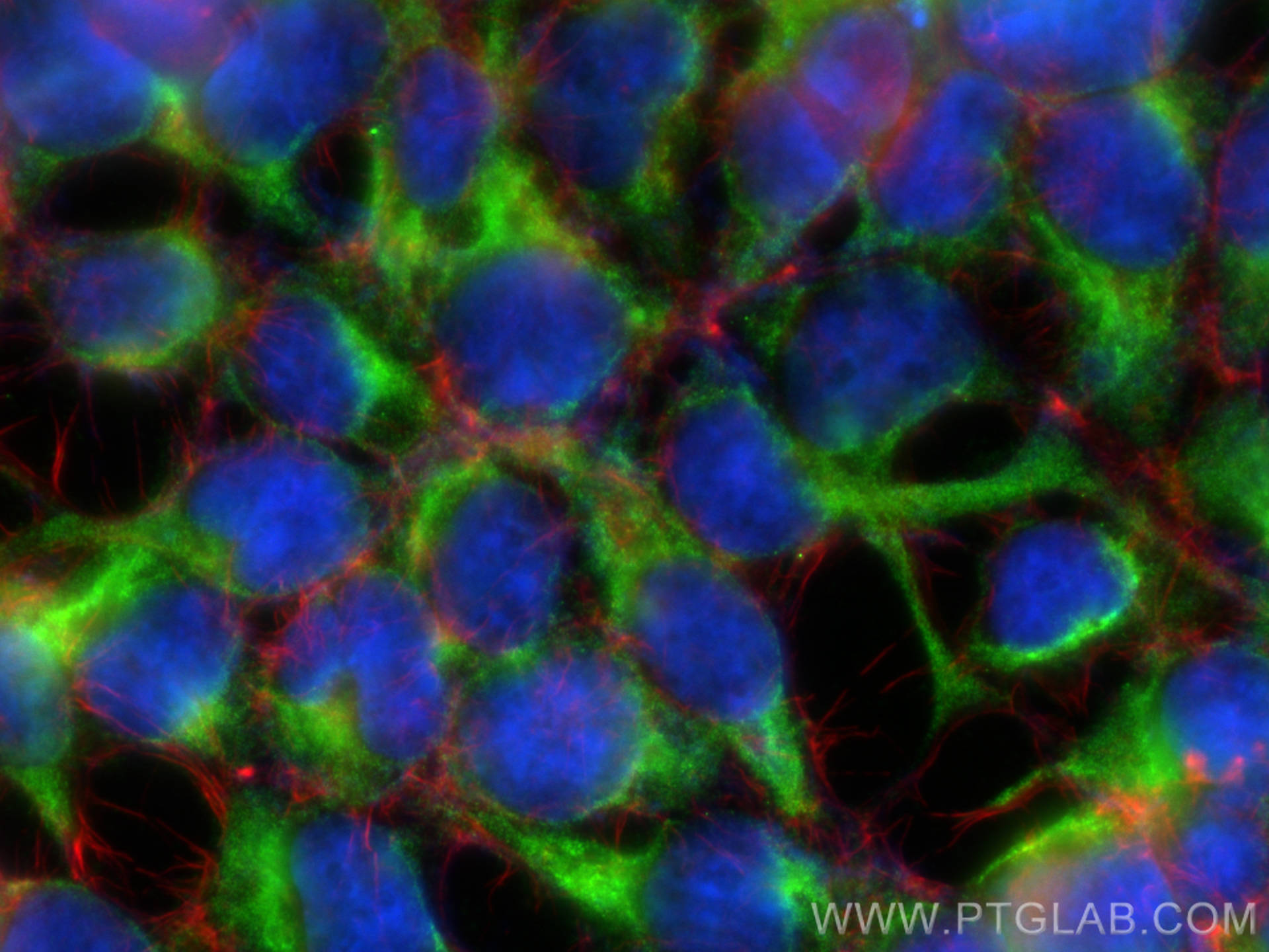 Immunofluorescence (IF) / fluorescent staining of HEK-293 cells using DCI Polyclonal antibody (11535-1-AP)