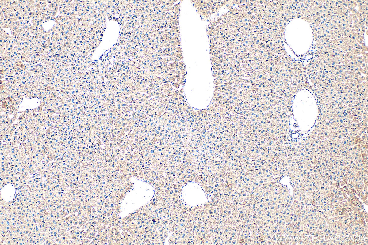 Immunohistochemistry (IHC) staining of mouse liver tissue using DCI Polyclonal antibody (11535-1-AP)