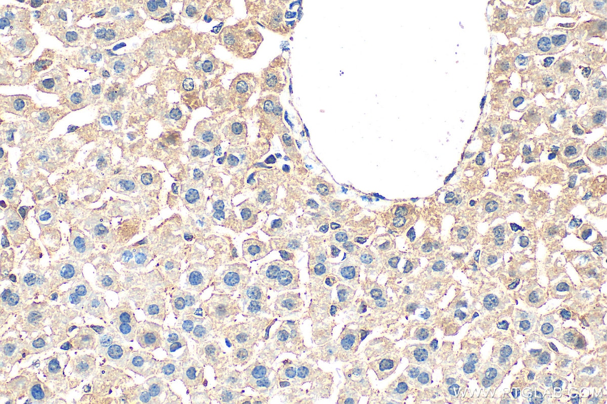 Immunohistochemistry (IHC) staining of mouse liver tissue using DCI Polyclonal antibody (11535-1-AP)