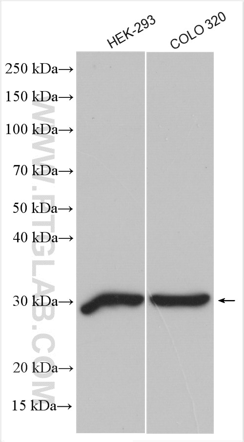 Western Blot (WB) analysis of various lysates using DCI Polyclonal antibody (11535-1-AP)