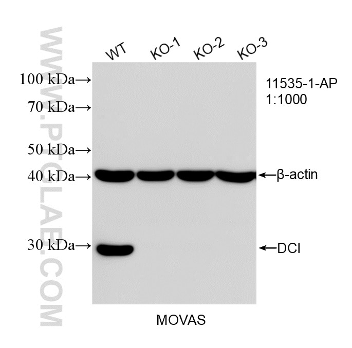Western Blot (WB) analysis of MOVAS cells using DCI Polyclonal antibody (11535-1-AP)