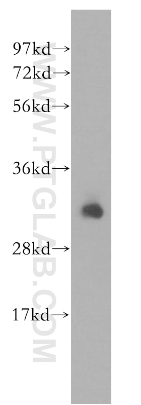 Western Blot (WB) analysis of human lung tissue using DCI Polyclonal antibody (11535-1-AP)