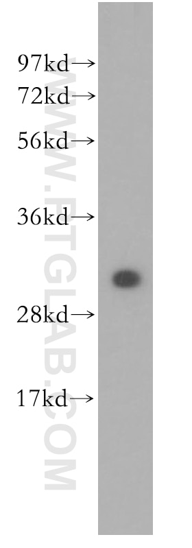 Western Blot (WB) analysis of human brain tissue using DCI Polyclonal antibody (11535-1-AP)