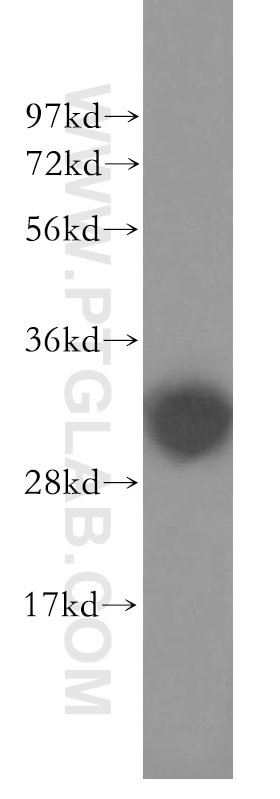 Western Blot (WB) analysis of human kidney tissue using DCI Polyclonal antibody (11535-1-AP)