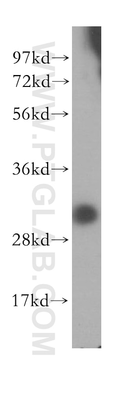 Western Blot (WB) analysis of BxPC-3 cells using DCI Polyclonal antibody (11535-1-AP)