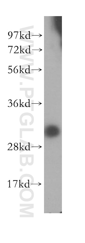 WB analysis of BxPC-3 using 11535-1-AP