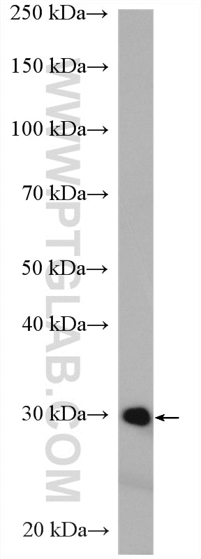 Western Blot (WB) analysis of HeLa cells using DCK Polyclonal antibody (17758-1-AP)