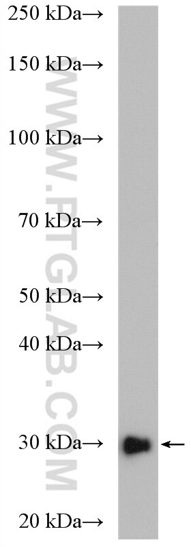 Western Blot (WB) analysis of Jurkat cells using DCK Polyclonal antibody (17758-1-AP)