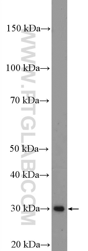 WB analysis of Jurkat using 17758-1-AP Western Blot (WB) analysis of Jurkat cells using DCK Polyclonal antibody (17758-1-AP)