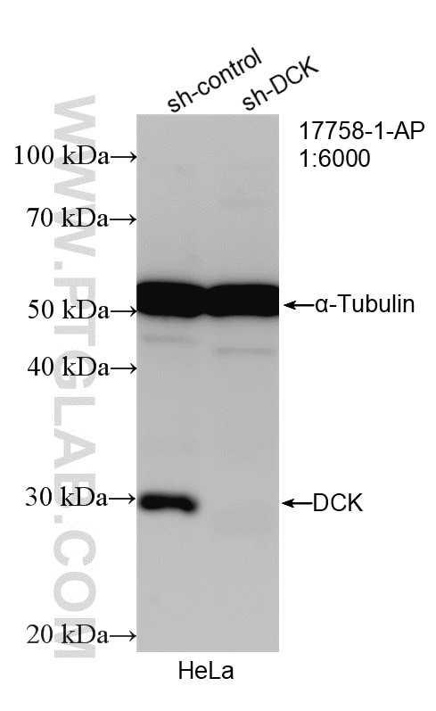 WB analysis of HeLa using 17758-1-AP Western Blot (WB) analysis of HeLa cells using DCK Polyclonal antibody (17758-1-AP)