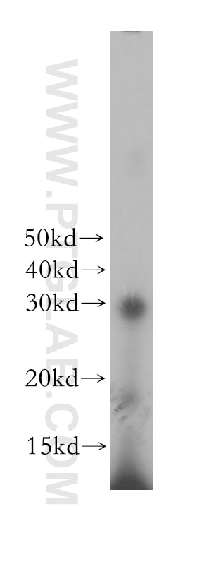 DCK Polyclonal antibody