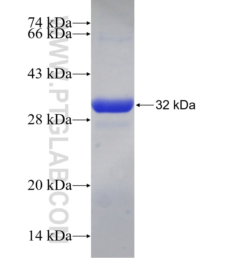 DCK fusion protein Ag12098 SDS-PAGE