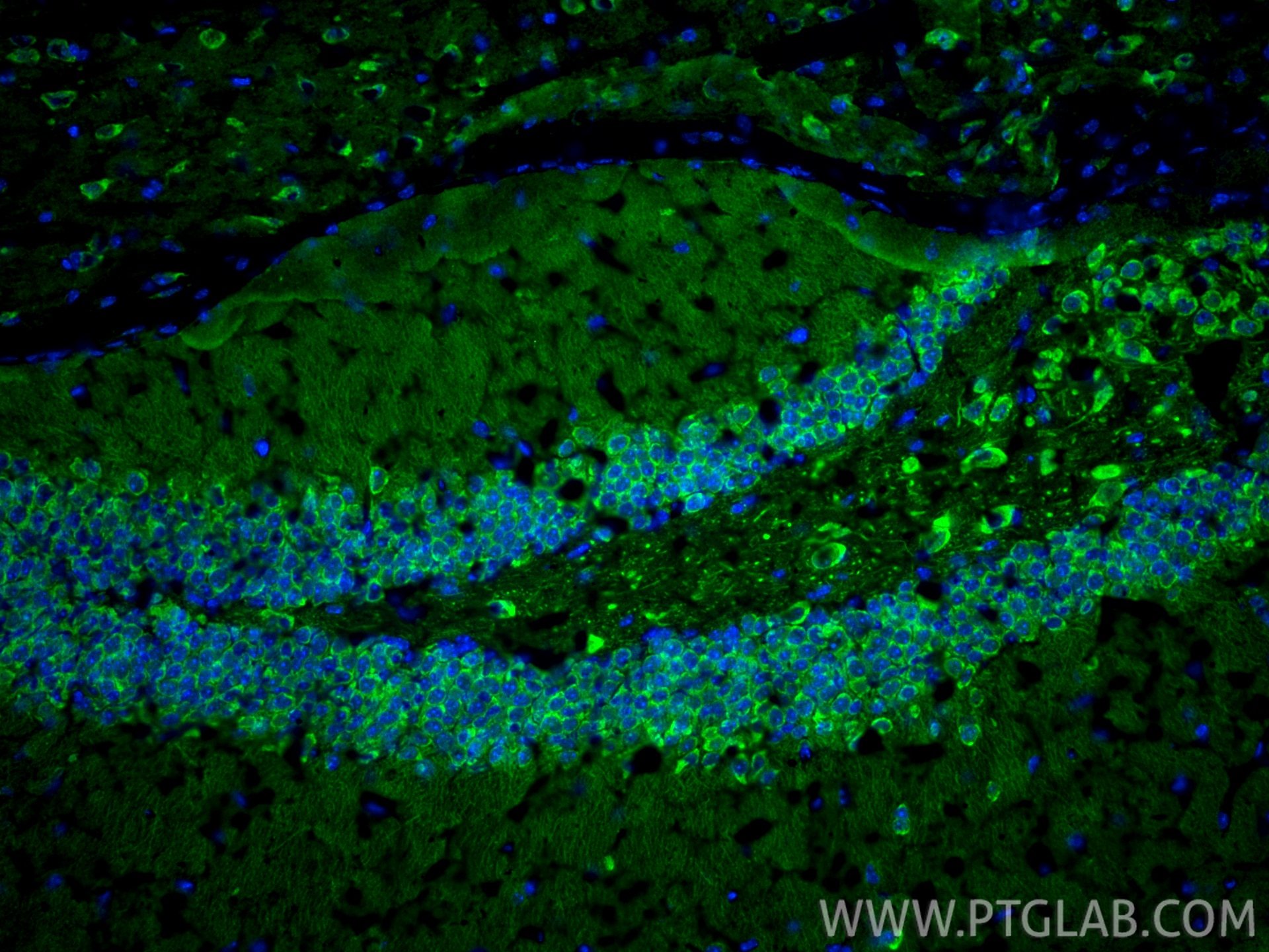Immunofluorescence (IF) / fluorescent staining of mouse brain tissue using DCLK1 Polyclonal antibody (21699-1-AP)