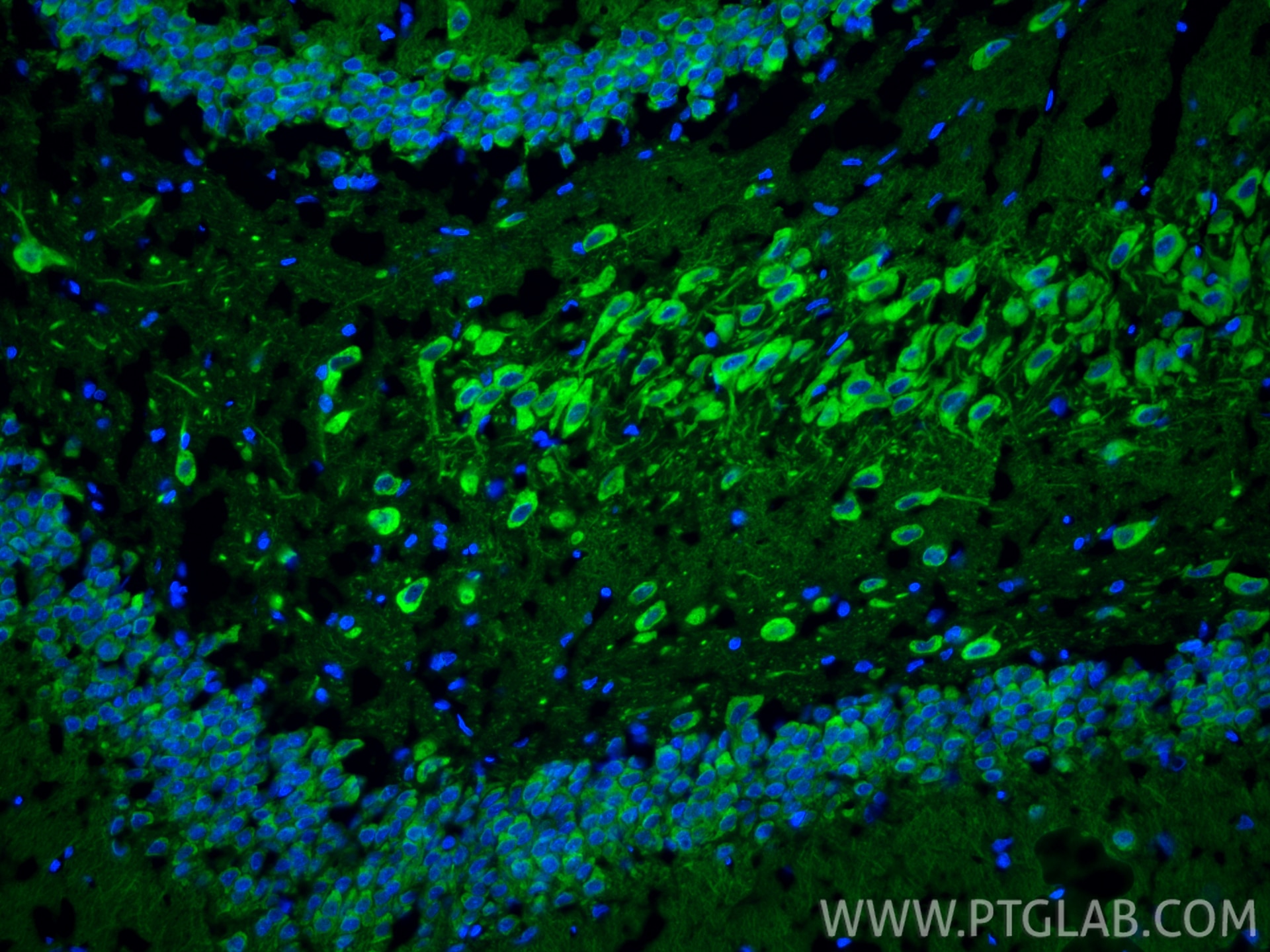 Immunofluorescence (IF) / fluorescent staining of rat brain tissue using DCLK1 Polyclonal antibody (21699-1-AP)