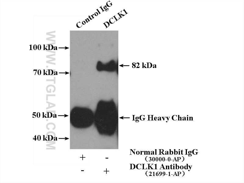 Immunoprecipitation (IP) experiment of rat brain tissue using DCLK1 Polyclonal antibody (21699-1-AP)