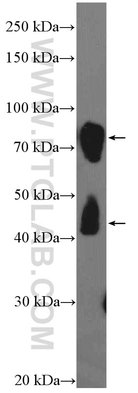 Western Blot (WB) analysis of rat brain tissue using DCLK1 Polyclonal antibody (21699-1-AP)