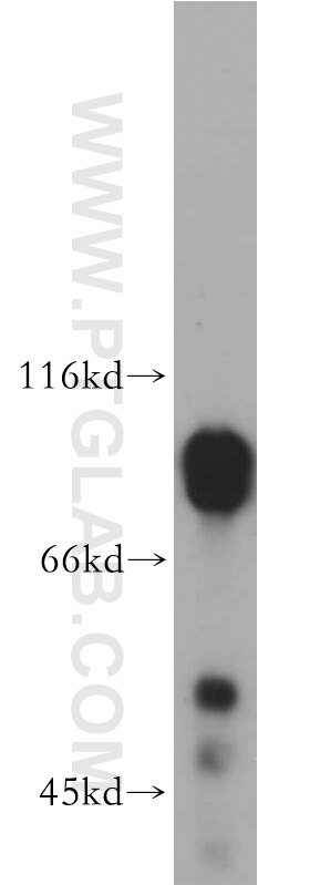 Western Blot (WB) analysis of human brain tissue using DCLK1 Polyclonal antibody (21699-1-AP)