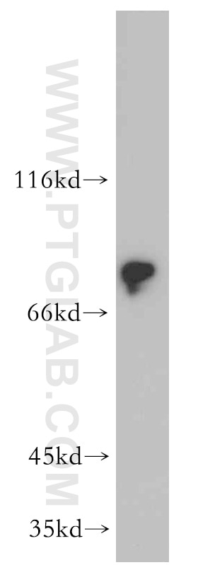 Western Blot (WB) analysis of mouse brain tissue using DCLK1 Polyclonal antibody (21699-1-AP)