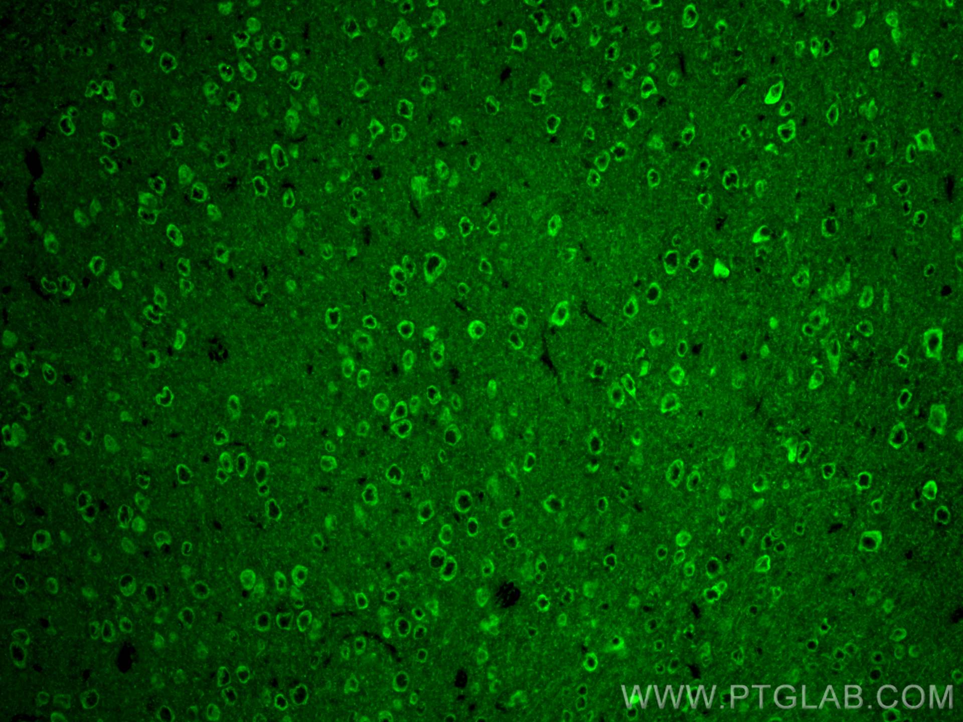 Immunofluorescence (IF) / fluorescent staining of mouse brain tissue using DCLK1 Polyclonal antibody (29800-1-AP)