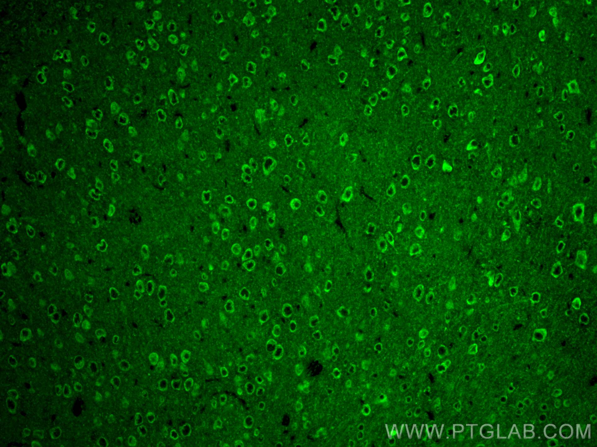 IF Staining of mouse brain using 29800-1-AP