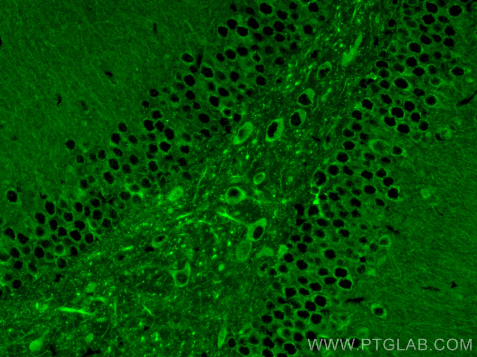 IF Staining of mouse brain using 29800-1-AP