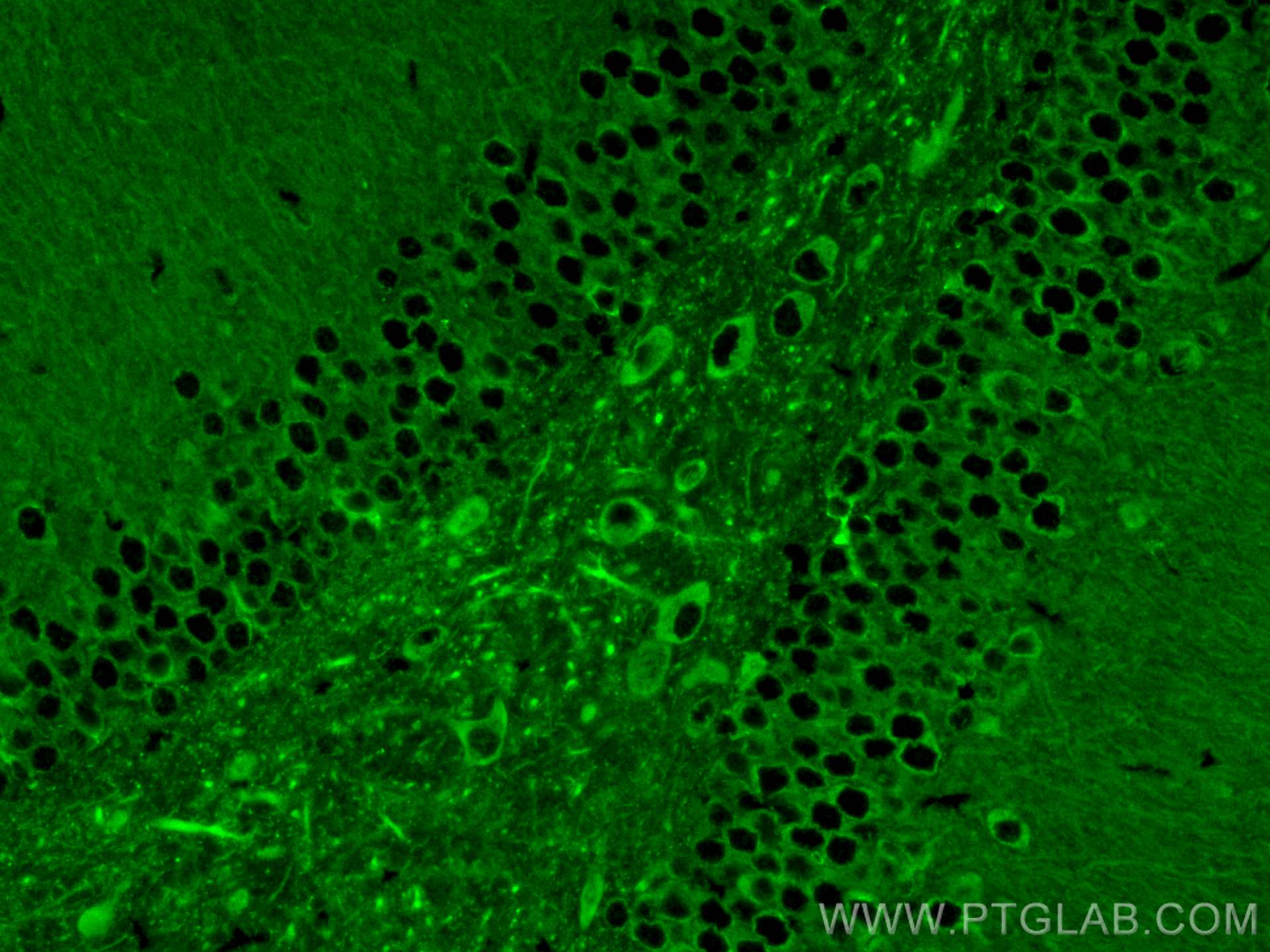 Immunofluorescence (IF) / fluorescent staining of mouse brain tissue using DCLK1 Polyclonal antibody (29800-1-AP)