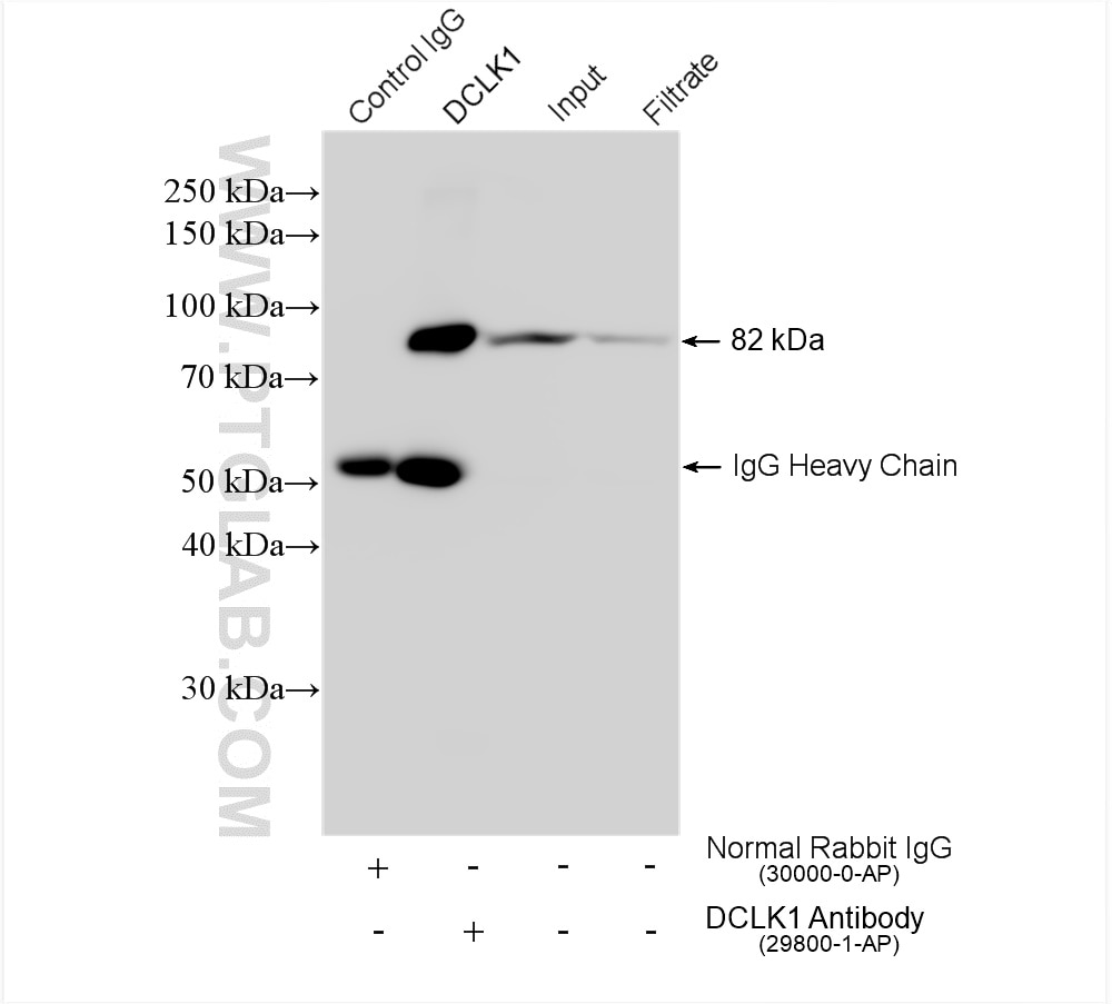 Immunoprecipitation (IP) experiment of mouse brain tissue using DCLK1 Polyclonal antibody (29800-1-AP)