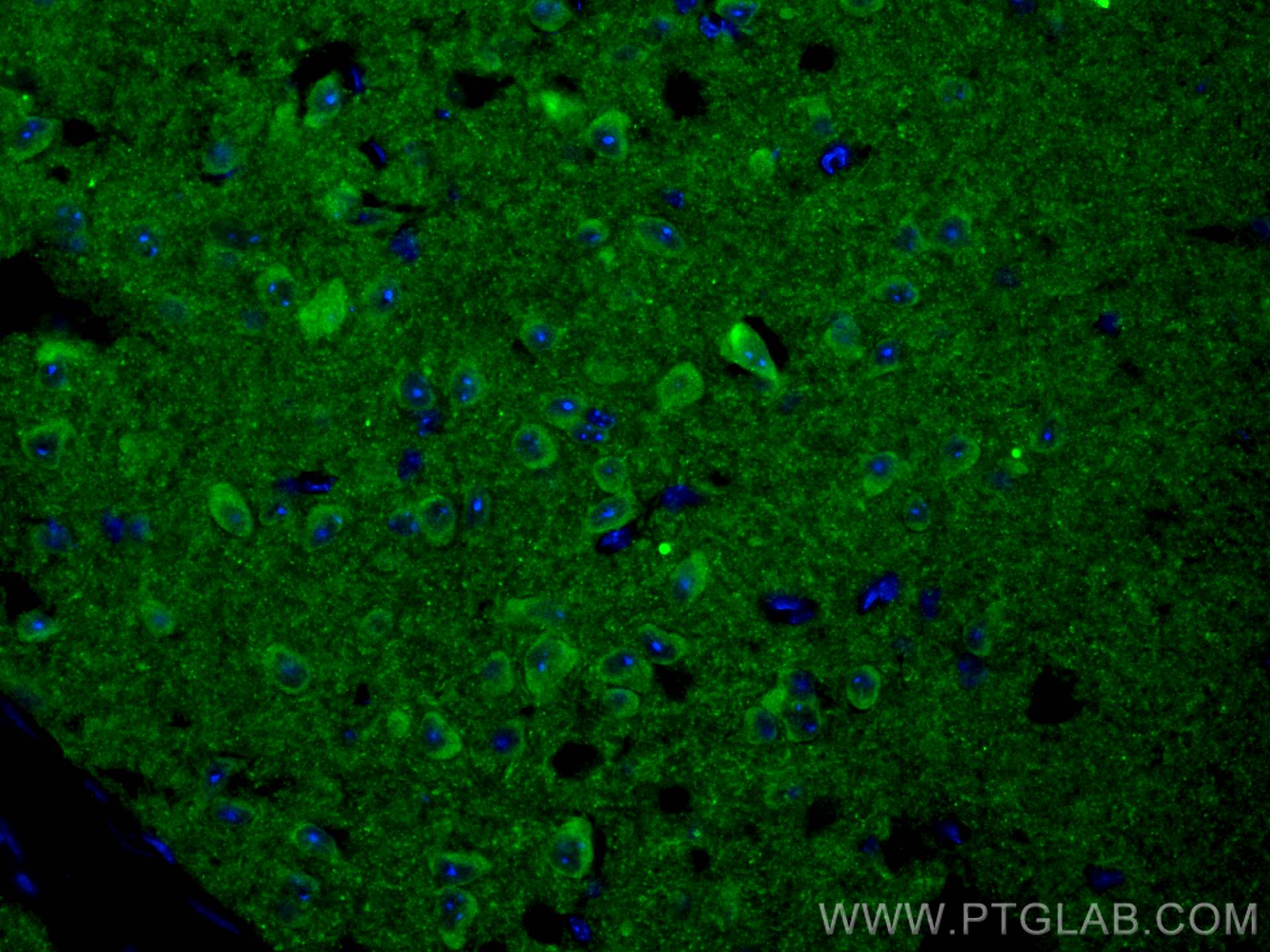 Immunofluorescence (IF) / fluorescent staining of mouse brain tissue using DCLK1 Monoclonal antibody (68234-1-Ig)