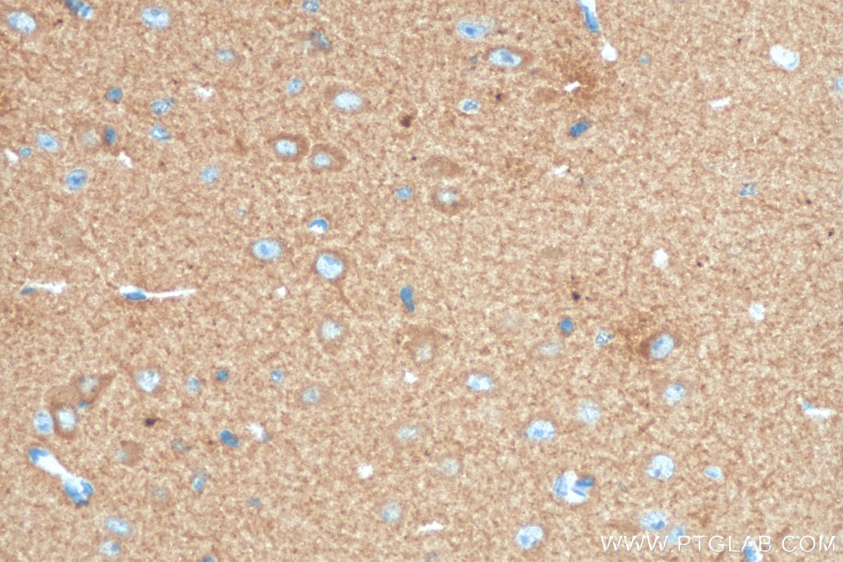 Immunohistochemistry (IHC) staining of mouse brain tissue using DCLK1 Monoclonal antibody (68234-1-Ig)