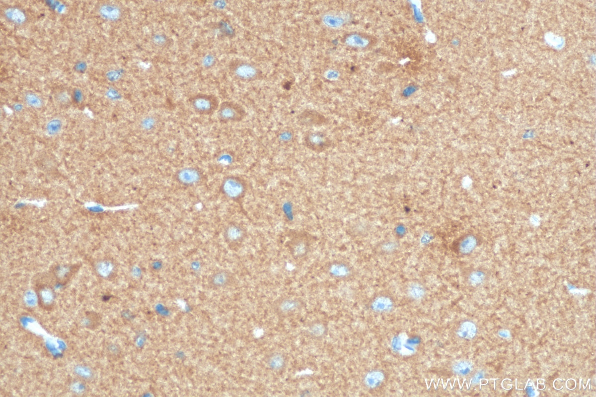 Immunohistochemistry (IHC) staining of mouse brain tissue using DCLK1 Monoclonal antibody (68234-1-Ig)