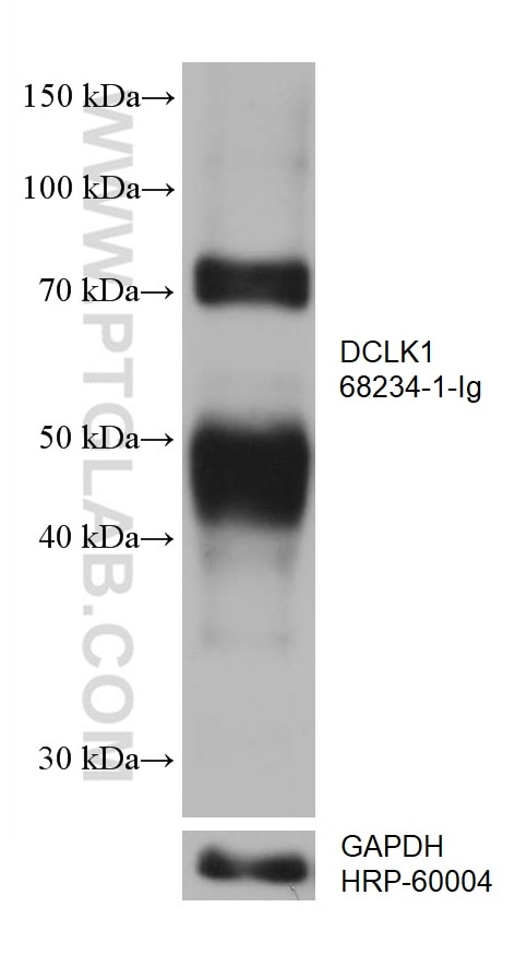 Western Blot (WB) analysis of fetal human brain tissue using DCLK1 Monoclonal antibody (68234-1-Ig)