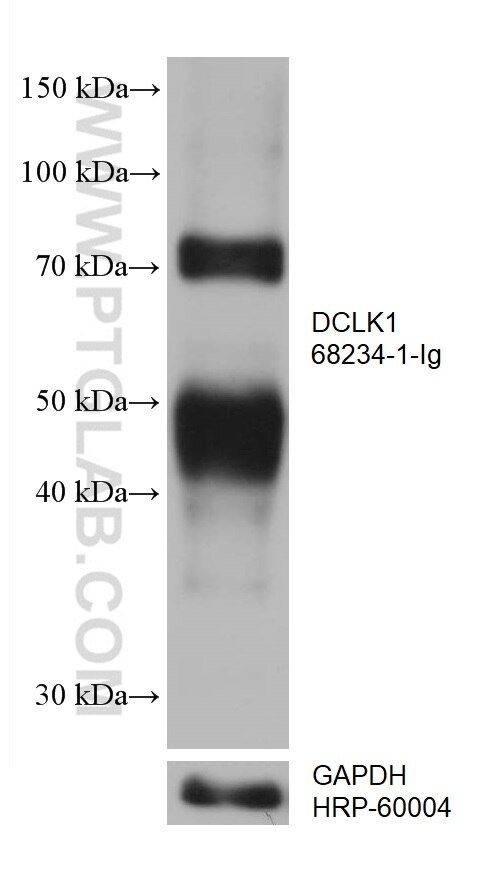 WB analysis of fetal human brain using 68234-1-Ig