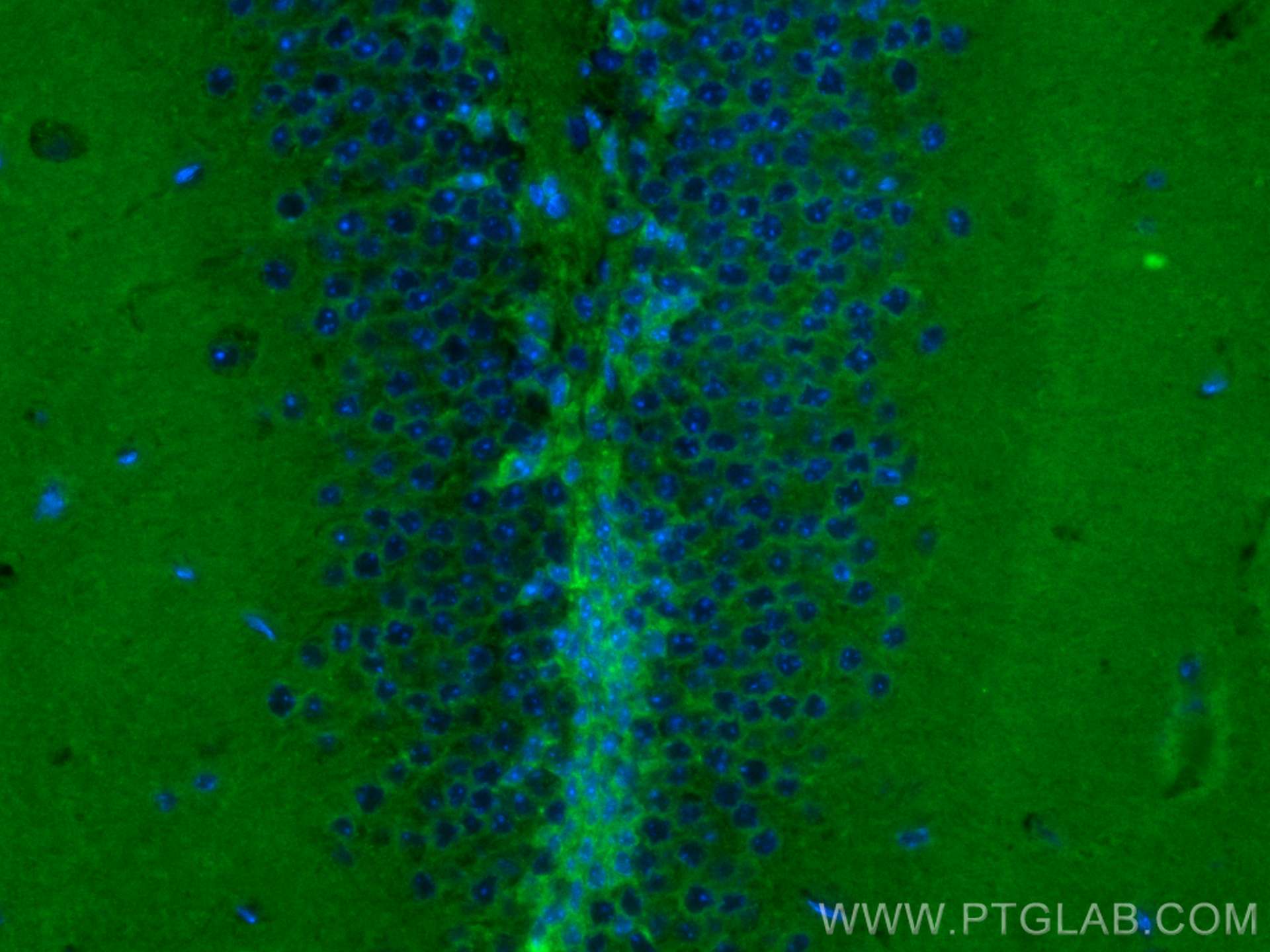 Immunofluorescence (IF) / fluorescent staining of mouse brain tissue using CoraLite® Plus 488-conjugated DCLK1 Monoclonal ant (CL488-68234)