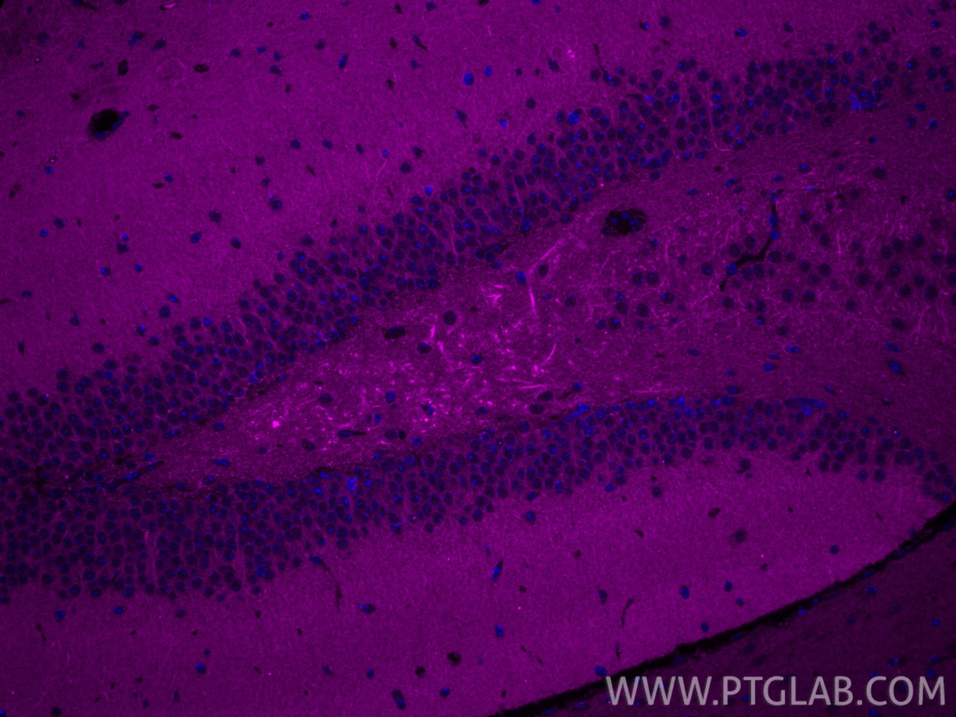Immunofluorescence (IF) / fluorescent staining of mouse brain tissue using CoraLite® Plus 647-conjugated DCLK1 Monoclonal ant (CL647-68234)